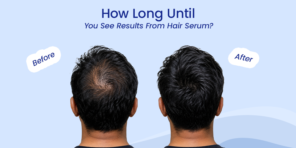 how long until you see results from hair serum