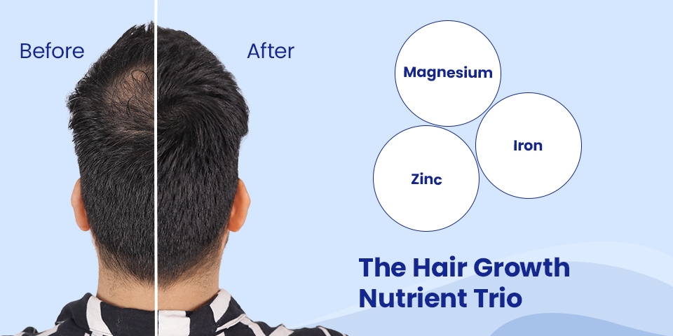 magnesium zinc iron the hair growth nutrient trio
