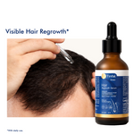 Tinfal b7 serum hair regrowth dropper bottle shown 