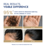 Before and after comparison of hair fall reduction and new hair growth