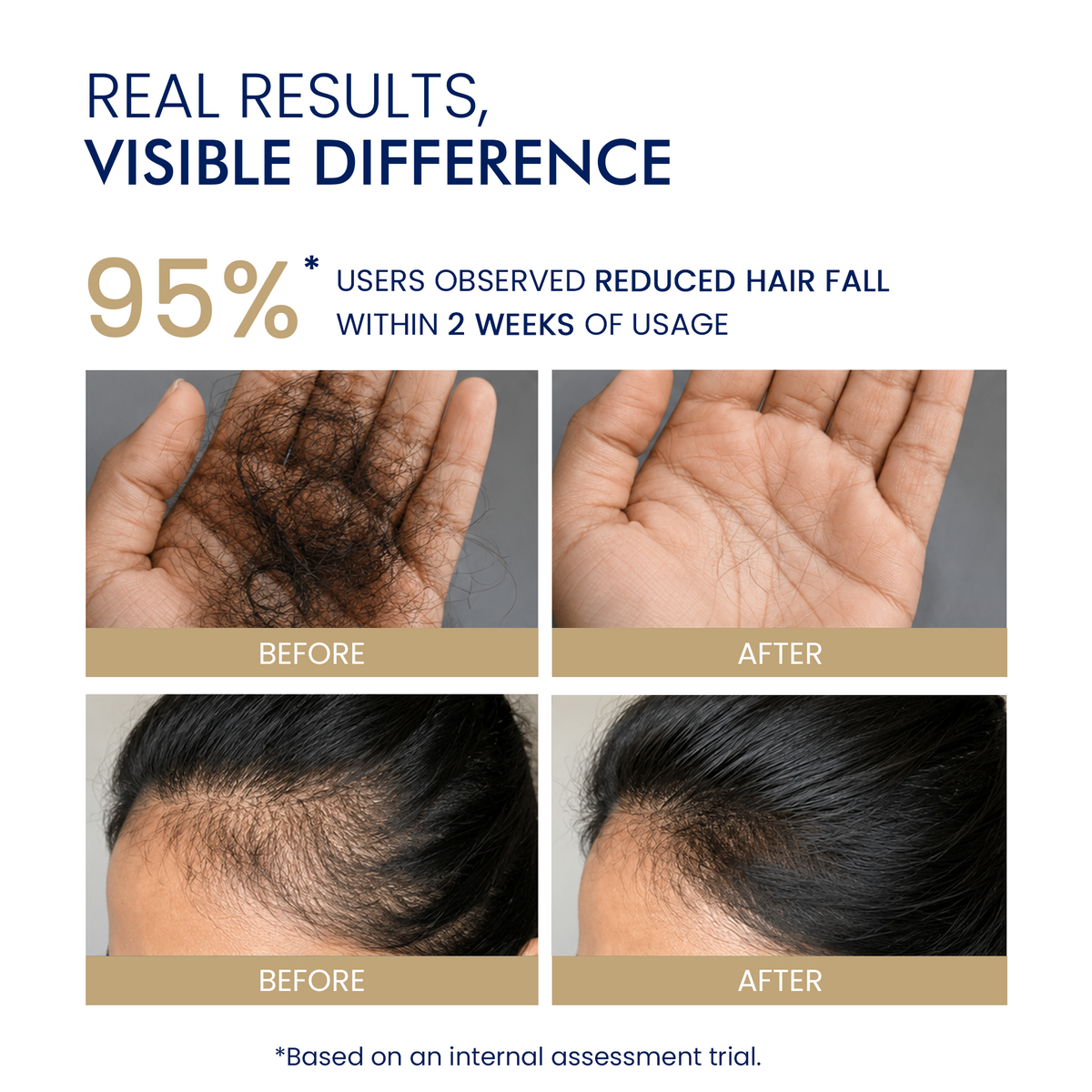 Before and after comparison of hair fall reduction and new hair growth