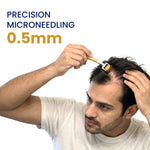 Man using a 0.5mm precision microneedling derma roller on thinning hair scalp