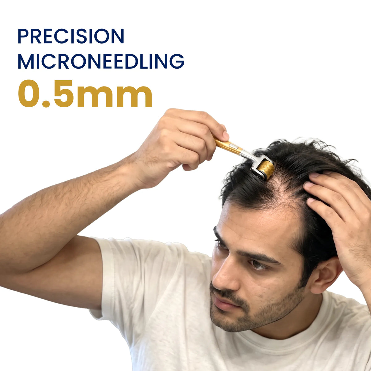 Man using a 0.5mm precision microneedling derma roller on thinning hair scalp