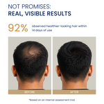 Before and after hair regrowth results showing increased density on crown
